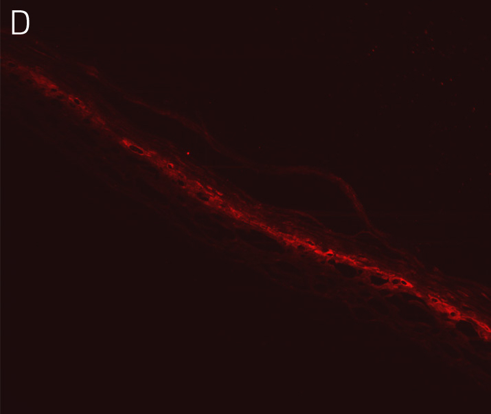 Keratinocytes with antibodies directed against filaggrin.
