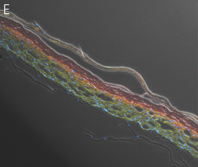 Keratinocytes showing an overlay of different stains.