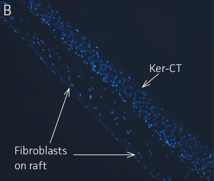 Arrows indicate nuclei of Ker-CT and dermal fibroblasts on cell image.