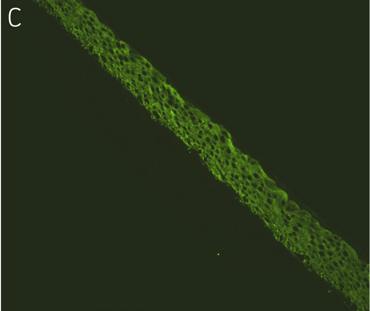 Ker-CT cells with antibodies directed against KRT14.