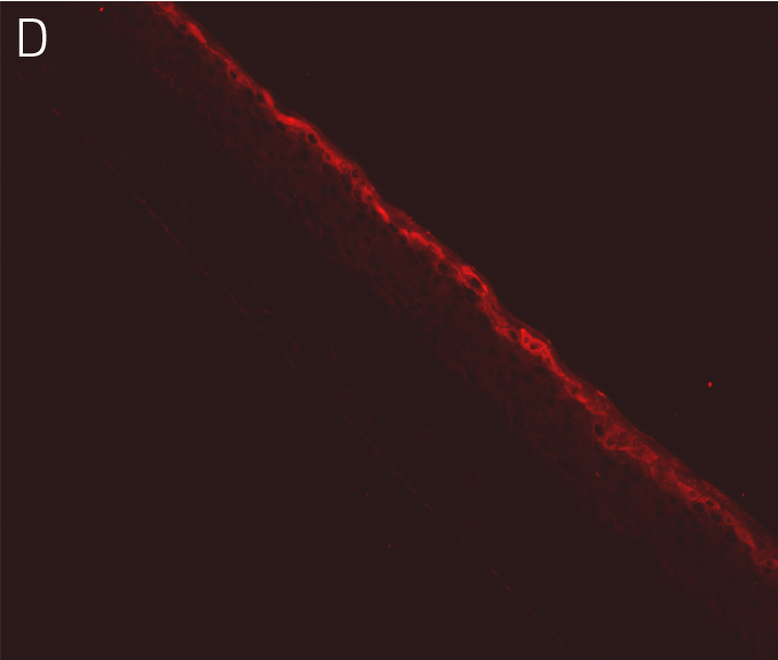 Ker-CT cells with antibodies directed against filaggrin.