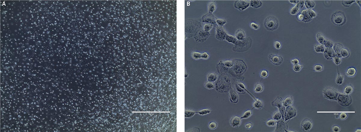 Changes in macrophage morphology by day 9.