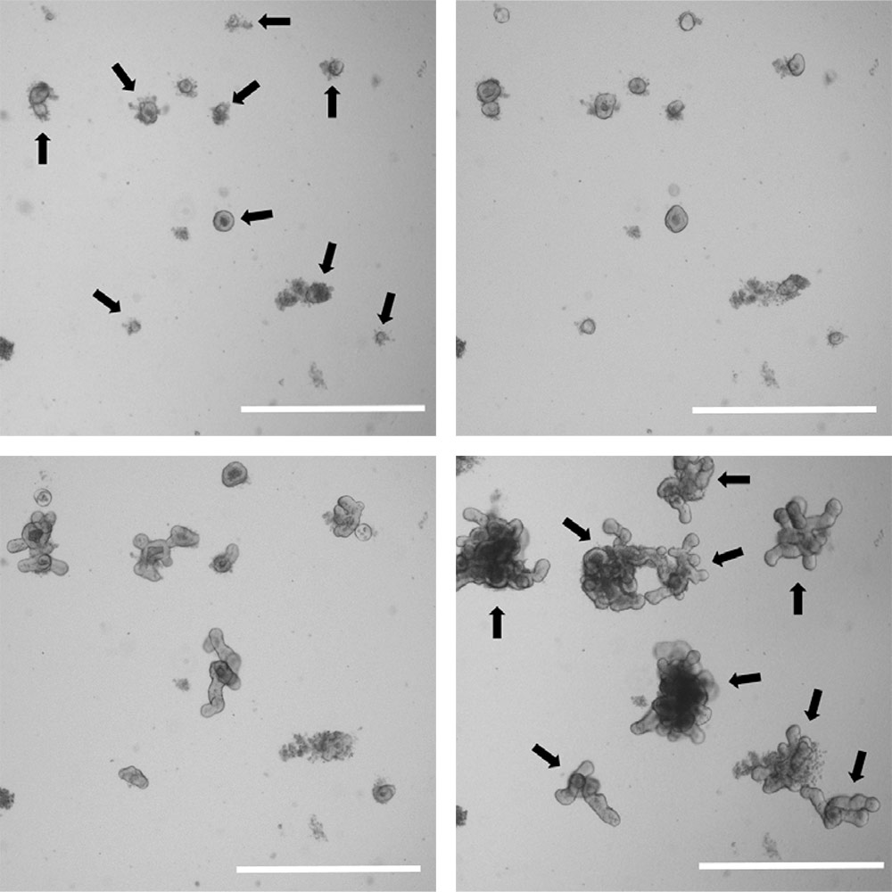 Organoids grow rapidly in size and complexity.