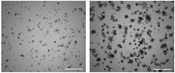 Appearance of organoid culture post-passage and after culture.
