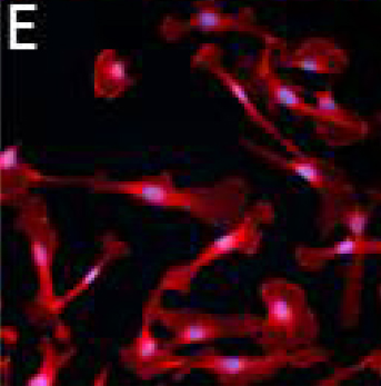 Figure E - Telomerase-immortalized Microvascular Endothelial Cells