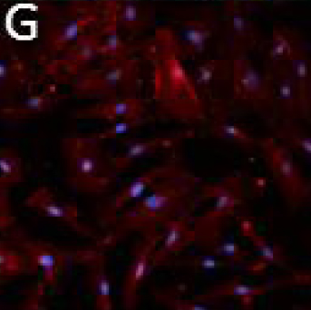 Figure G - Telomerase-immortalized Microvascular Endothelial Cells