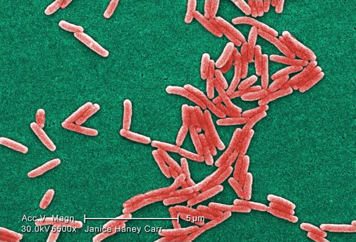 Image of Gram-negative Legionella pneumophila bacteria