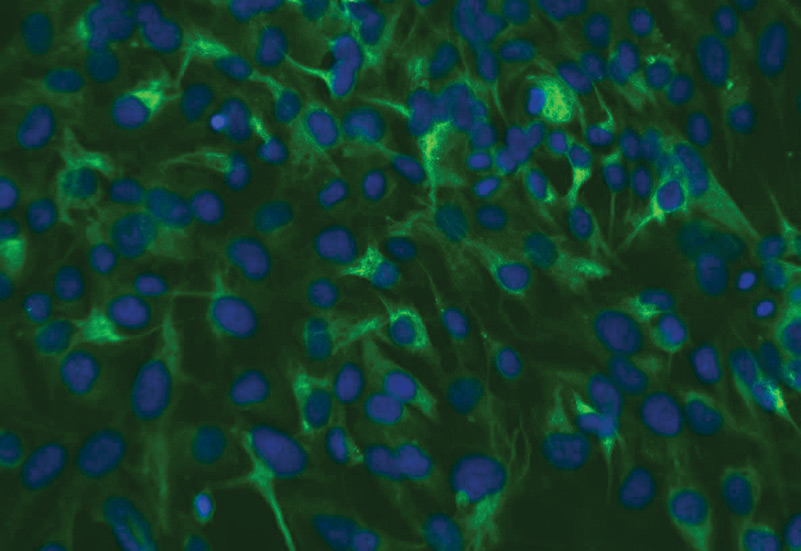 ATCC CRL-4004 stained with a monoclonal pan-cytokeratin antibody (green) and Hoechst dye (blue)