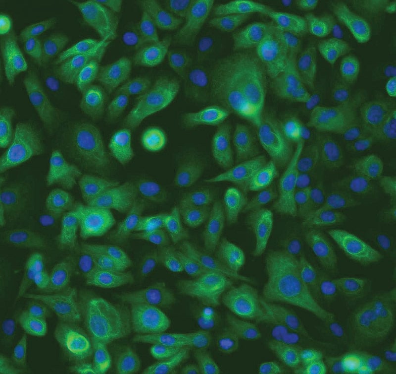 ATCC CRL-4010 stained with a monoclonal pan-cytokeratin antibody (green) and Hoechst dye (blue)