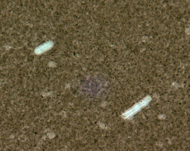 Capsule stain of Bacillus anthracis. Photo courtesy of Larry Stauffer and CDC.