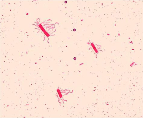 Leifson flagella stain of Bacillus cereus (Peritrichous). Photo  courtesy of Dr. William A. Clark and CDC