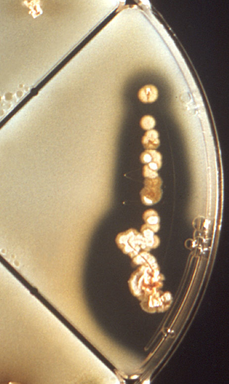 Casease positive test. Photo courtesy of Dr. David Berd and CDC.