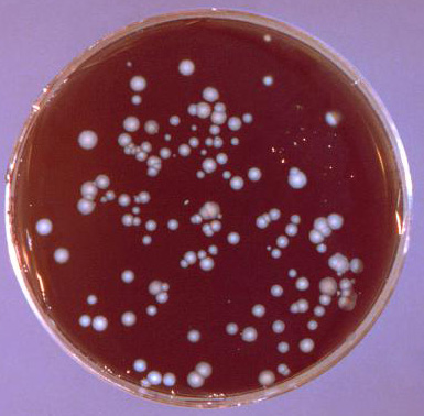 Example of a spread plate exhibiting isolated colonies of Legionella pneumophilia following incubation. Photo courtesy of Dr. Jim Feeley and CDC.