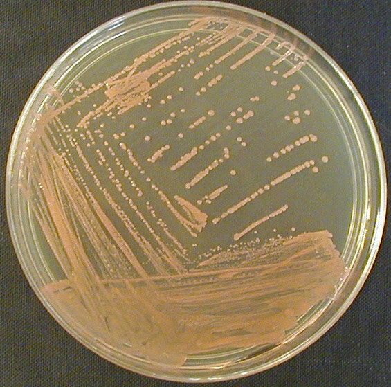 Example of a streak plate exhibiting isolated colonies following  incubation