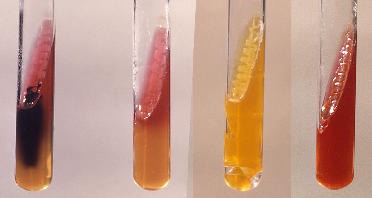 Test tube examples of triple sugar iron agar results.