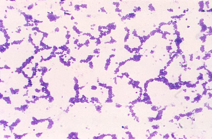 Gram stain of Staphylococcus aureus (Gram-positive). Photo courtesy of Dr. Richard Facklam and CDC.