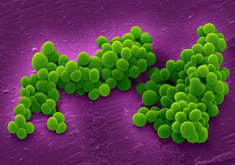 Staphylococcus aureus - cocci bacteria with staphylococci arrangement
