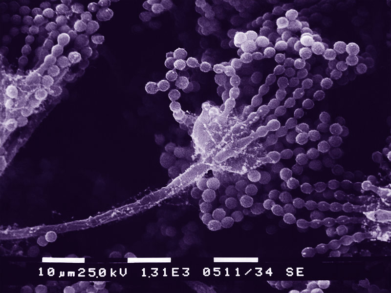 Aspergillus sp.
