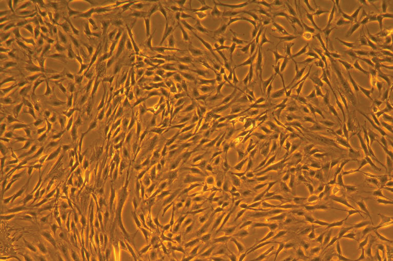 Adipose-Derived Mesenchymal Stem Cells: Normal, Human (ATCC PCS-500-011)