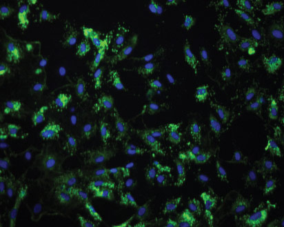 Blue-purple and green spots of Primary Dermal Microvascular Endothelial Cells