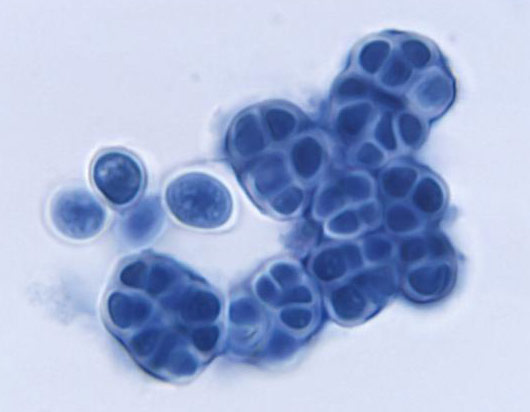 Prototheca filamenta alga.