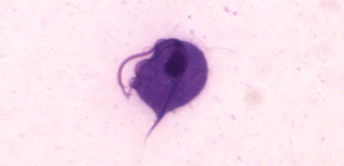 Trichomonas vaginalis.