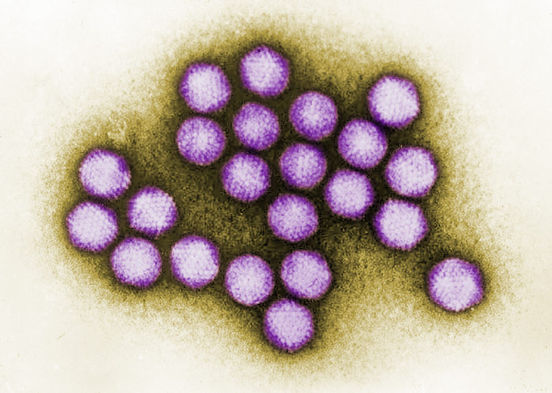 Adenovirus.