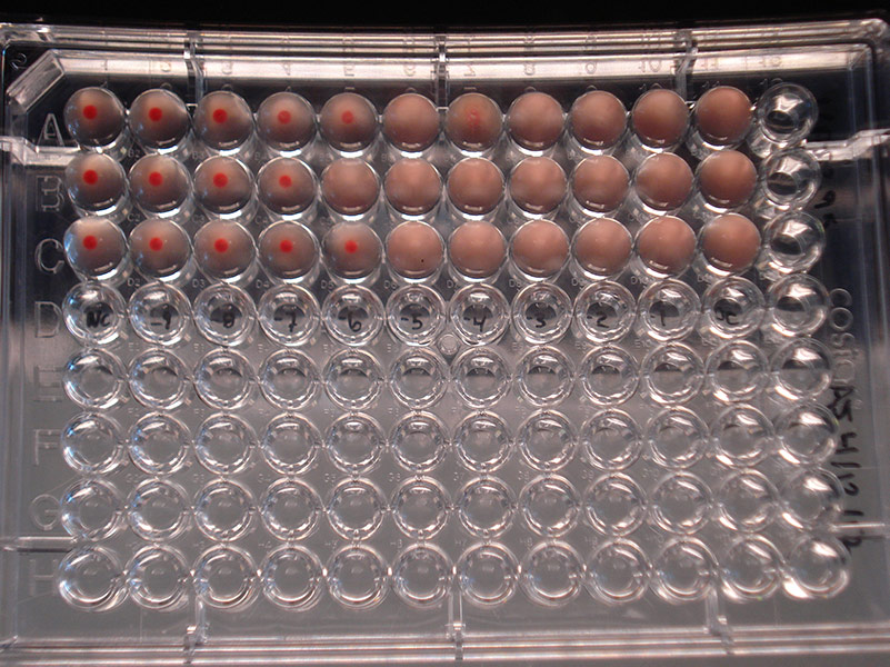 Hemagglutination assay depicting Influenza B virus at varying dilutions.