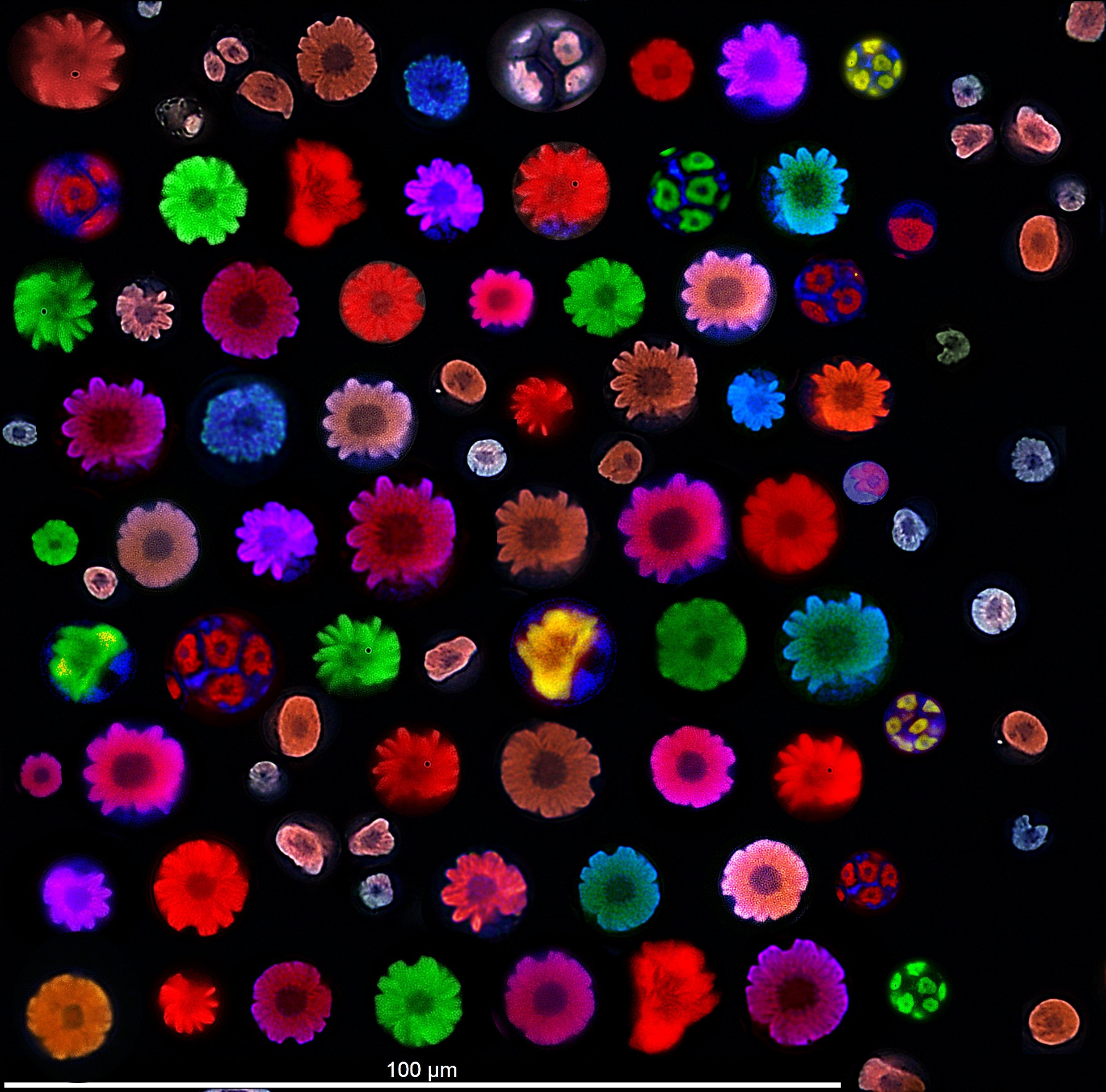 Fluorescence microscopy of a collage of different cellular stages of Trebouxia