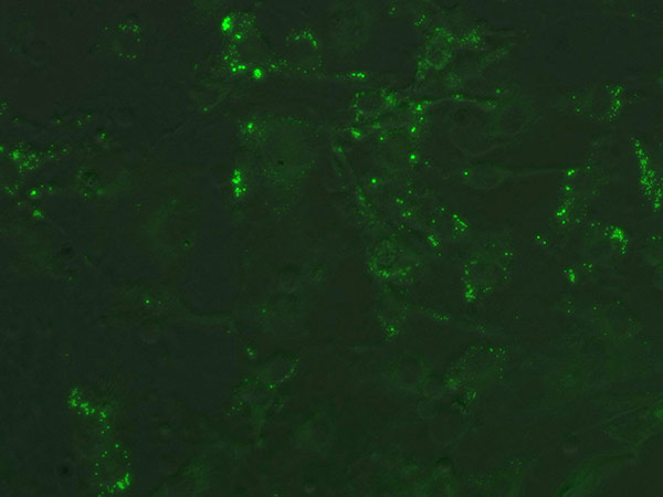 Confluent 3T3-L1 cells stained with Nile Red prior to induction.