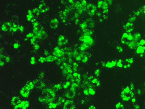 Differentiated 3T3-L1 cells stained with Nile Red