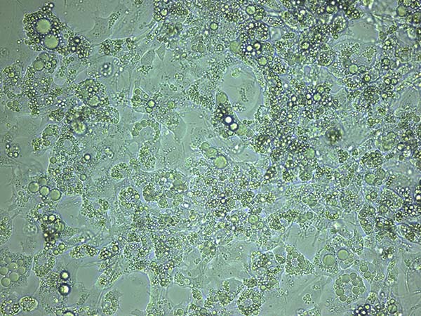 Light microscopy of differentiated 3T3-L1 cells