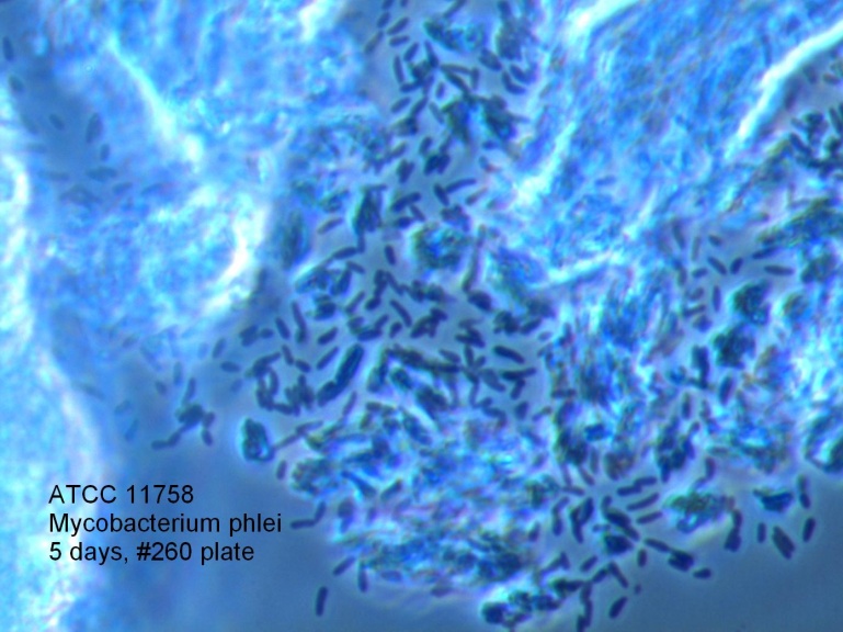 11758 Micrograph of bacteria at 1000X magnification