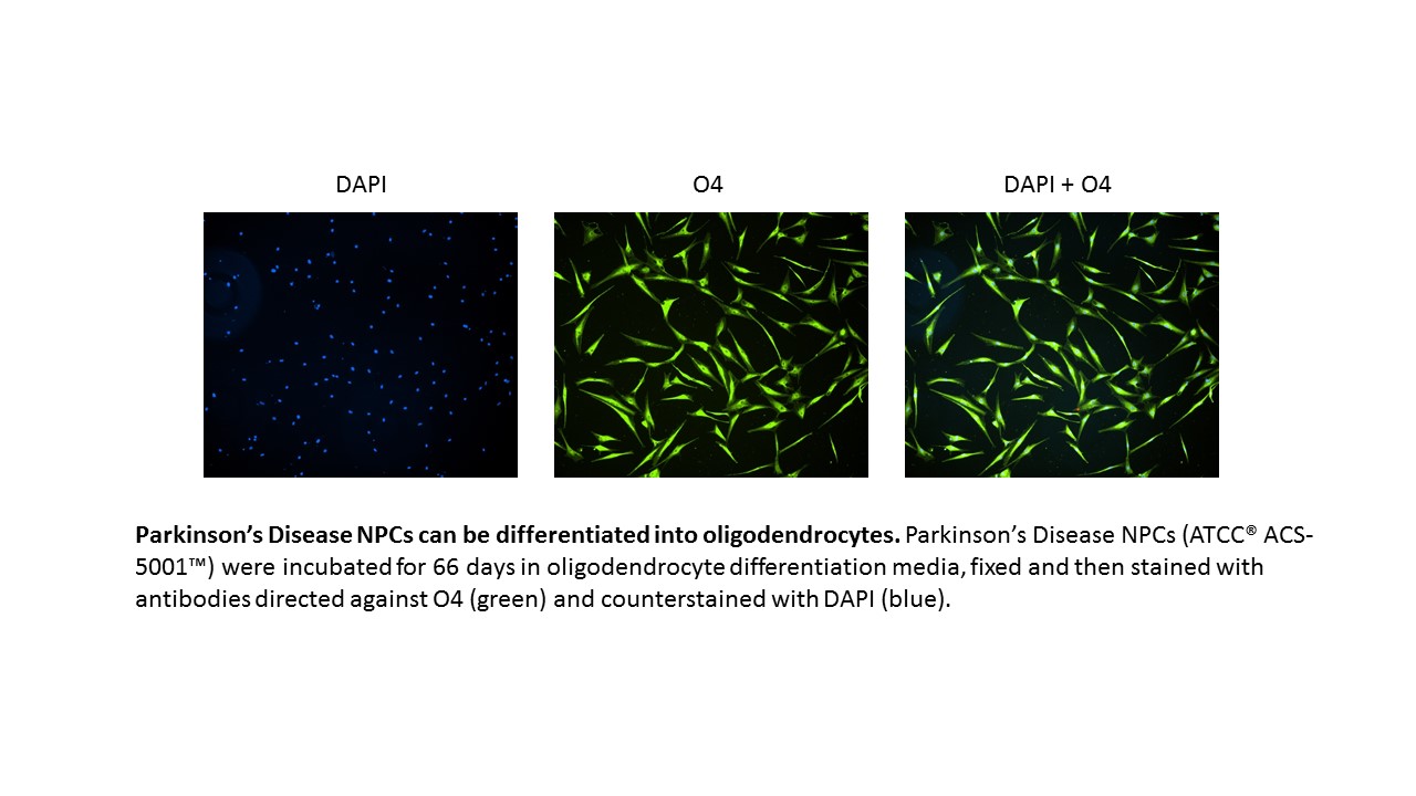Parkinsons NPC Oligodendrocyte Expression