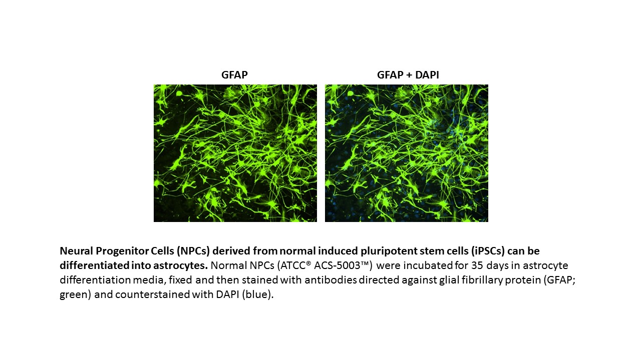 ACS-5003 Astrocyte Markers