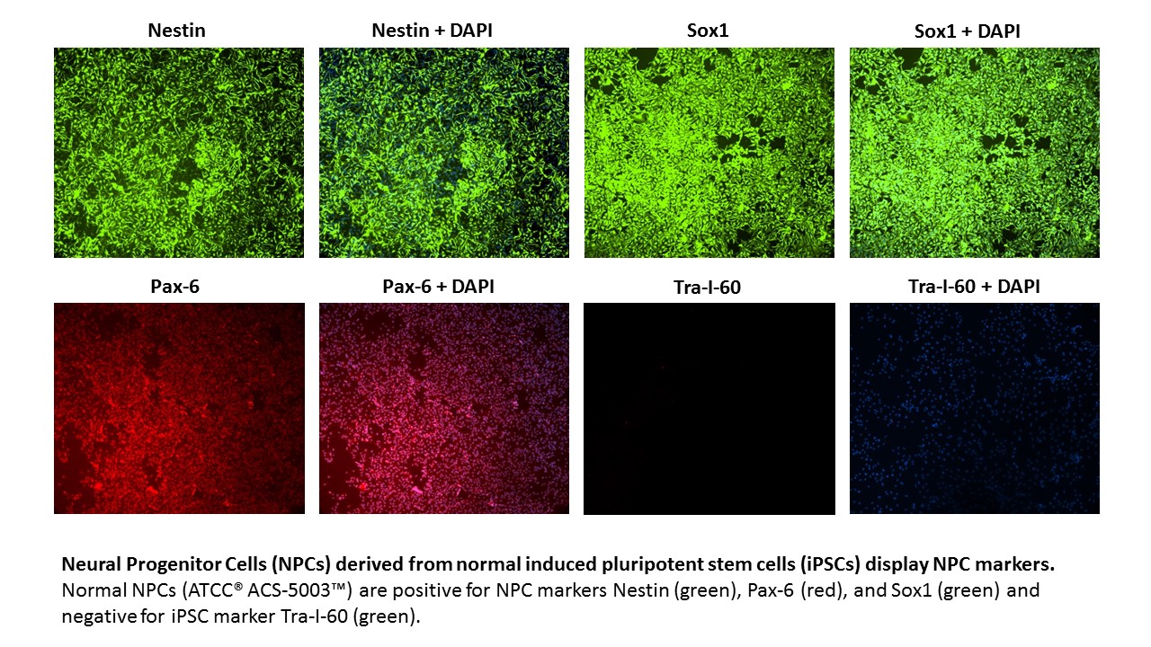 ACS-5003 NPC Markers