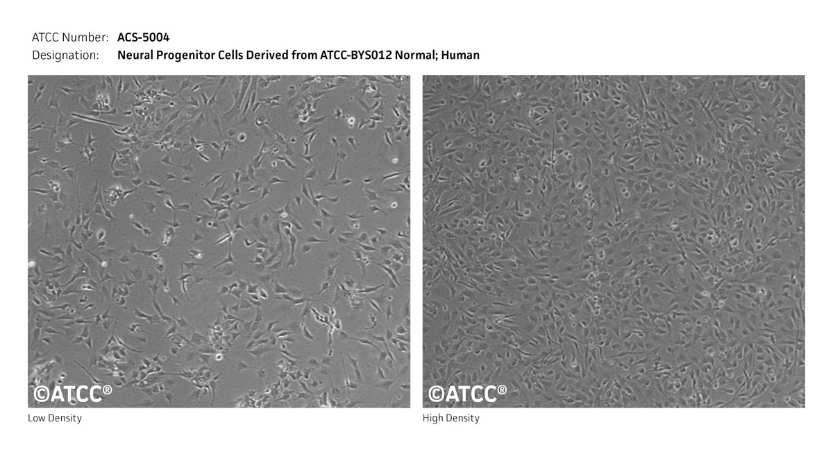 ACS-5004 Micrograph