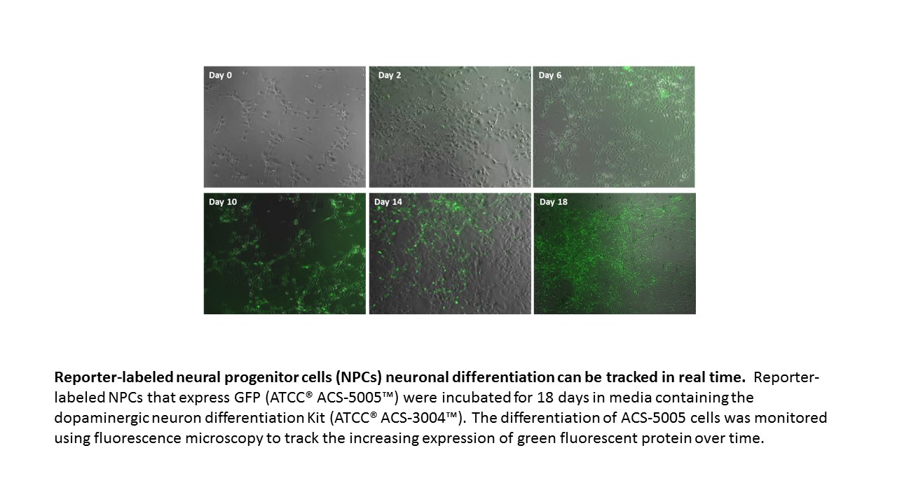 ACS-5005 Neuronal Expression GFP