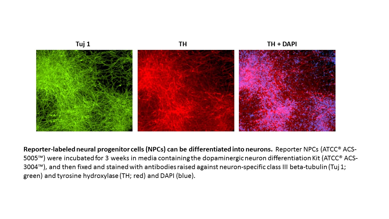 ACS-5005 Neuronal Expression