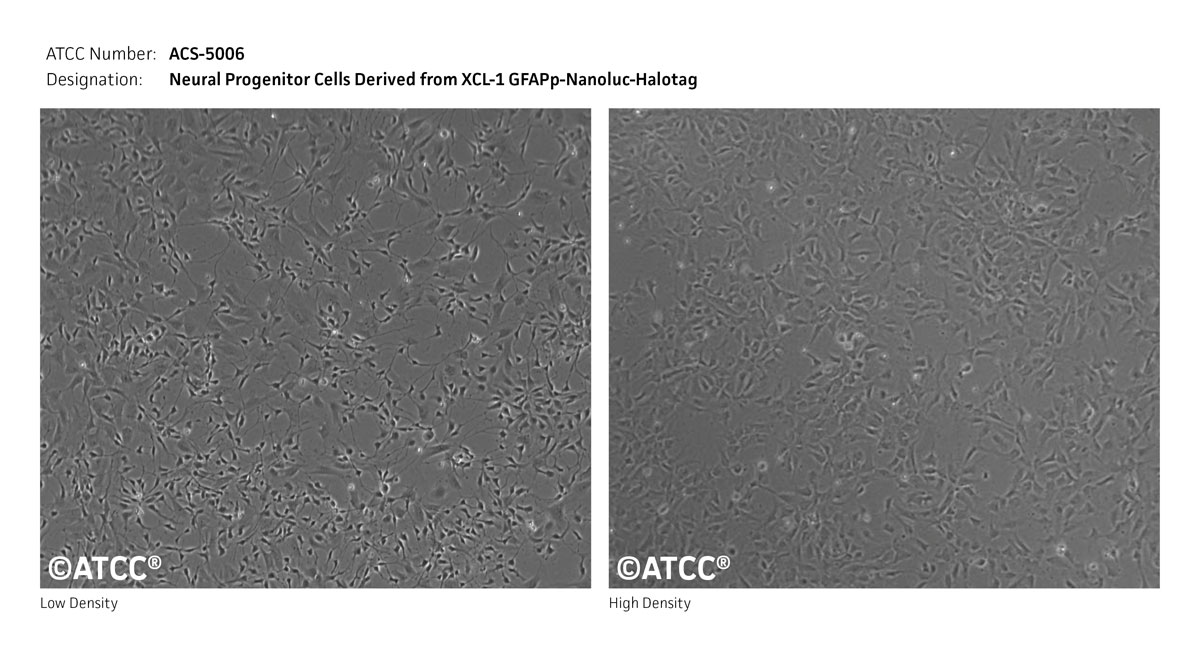 Cell Photomicrograph of ATCC ACS-5006 cells