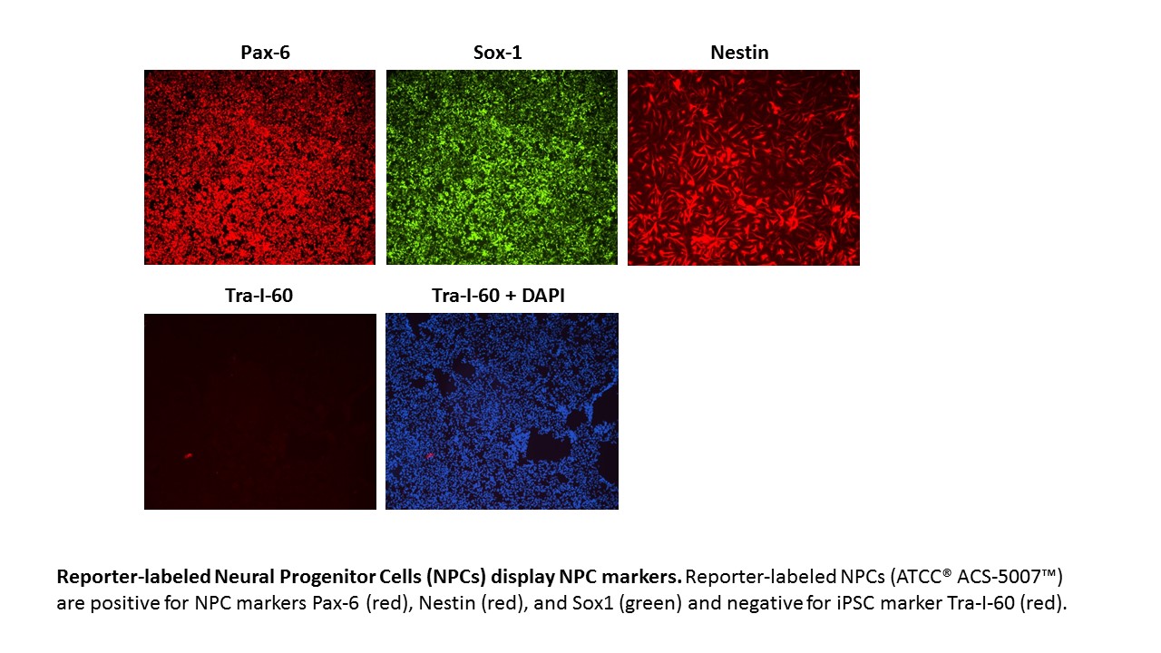 ACS-5007 NPC Markers