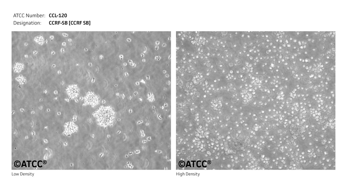 ATCC CCL-120 Cell Micrograph