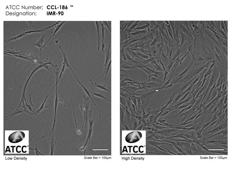 CCL-186 Micrograph