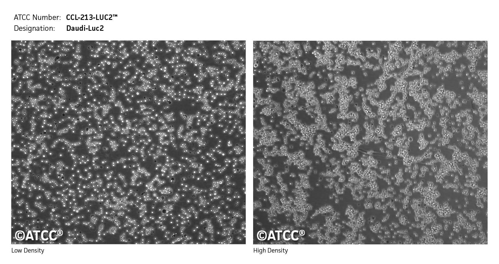 Cell Micrograph CCL-213-LUC2