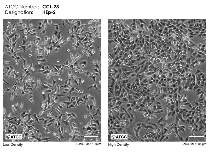 CCL-23 micrograph