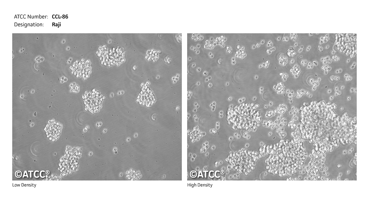 CCL-86 Micrograph