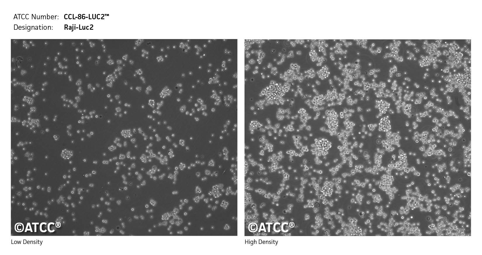 Cell Micrograph CCL-86-LUC2