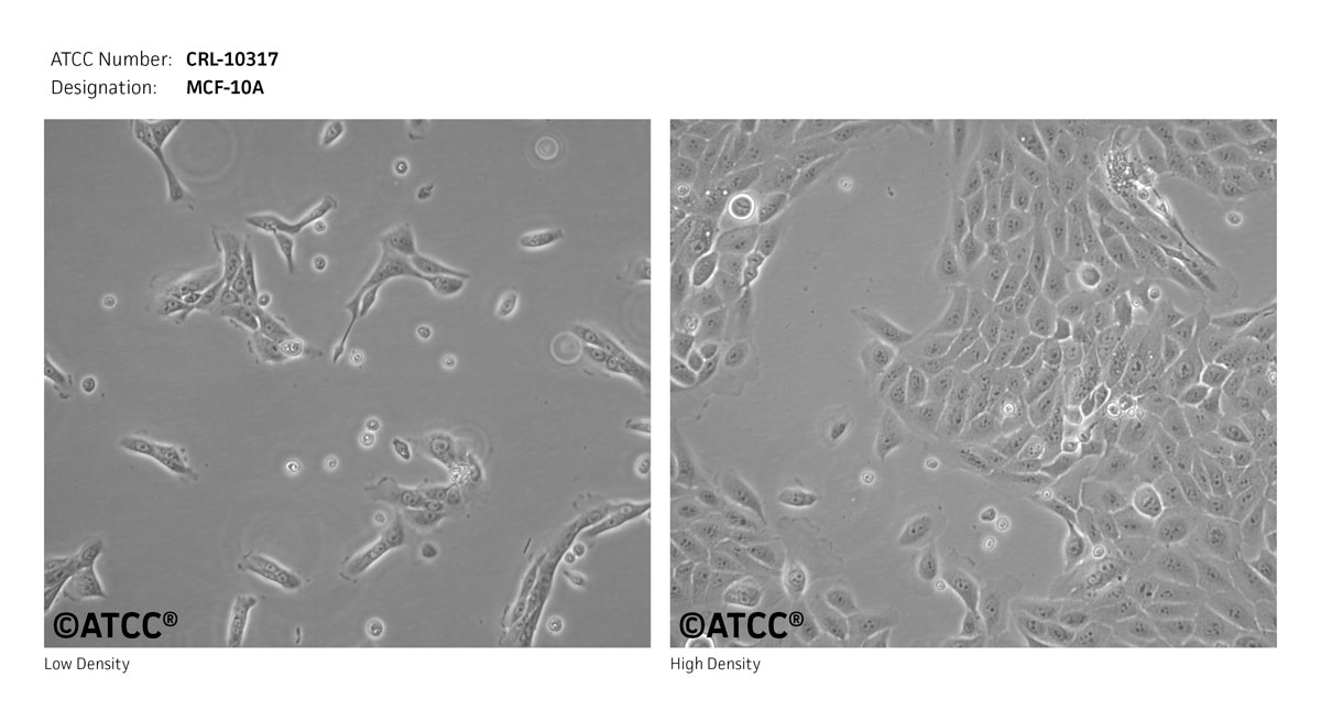 Cell Micrograph of ATCC CRL-10317