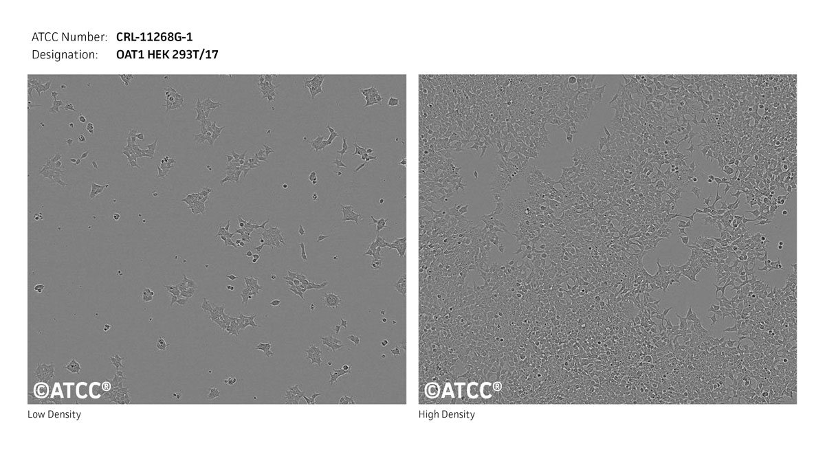 Cell Micrograph of ATCC CRL-11268G-1 