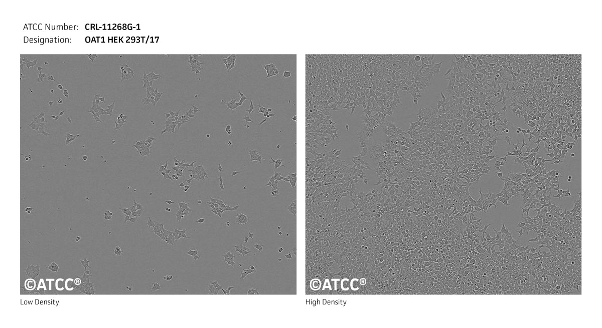 Cell Micrograph of ATCC CRL-11268G-1 